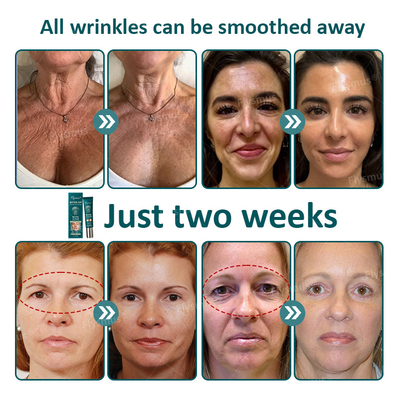 Flysmus® Botox Jellyfish Venom Peptide Nanoliposome Sculpting Anti-Wrinkle Cream – Hot Seller! 🔥Limited-Time Offer: Save 40%!