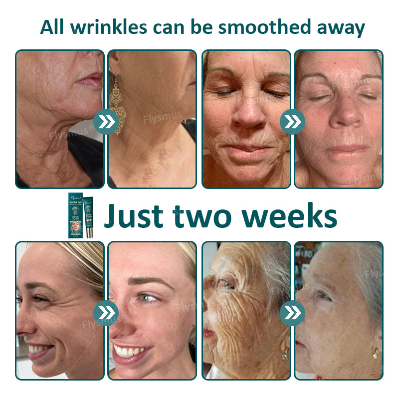 Flysmus® Botox Jellyfish Venom Peptide Nanoliposome Sculpting Anti-Wrinkle Cream – Hot Seller! 🔥Limited-Time Offer: Save 40%!