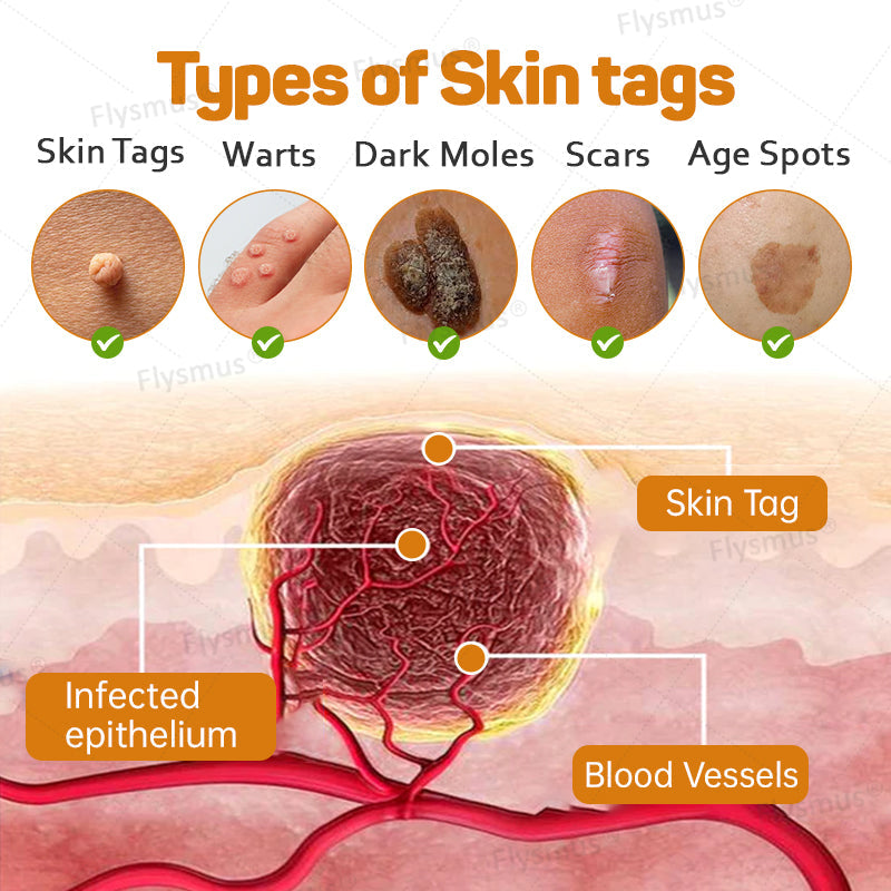 🌿Flysmus® Tag Recede Bee Venom Treatment Cream-LAST DAY 70% OFF-Maximize Skin Renewal