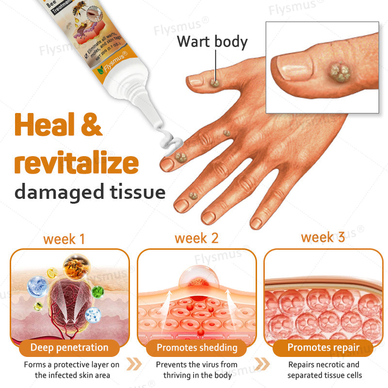 🌿Flysmus® Tag Recede Bee Venom Treatment Cream-LAST DAY 70% OFF-Maximize Skin Renewal
