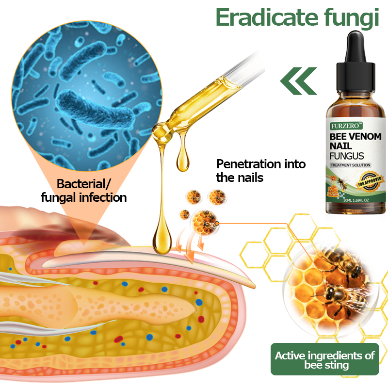 👩‍⚕️Furzero™ Bee Venom Nail Fungus Treatment Solution(For All Kinds Of Nail Diseases✅For Healthier Nail Growth)