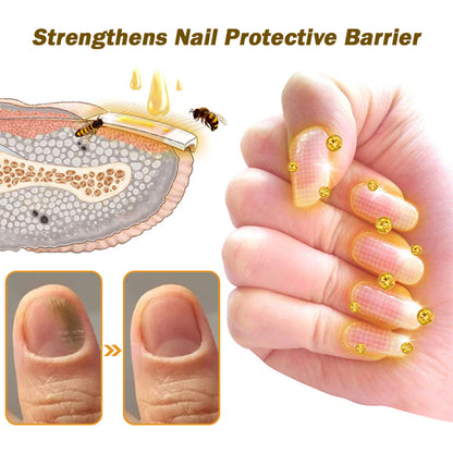 🐝Furzero™ Nail Defense Bee Venom Treatment Serum