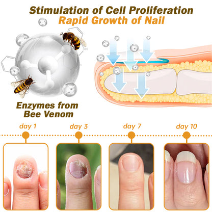 🐝Furzero™ Nail Defense Bee Venom Treatment Serum