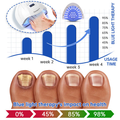 👍Furzero™ PureNail Fungus Laser Therapy Device