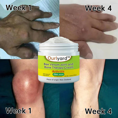 Ourlyard™ Bee Venom Joint and Bone Therapy Cream -