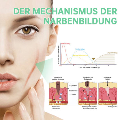 ❤️Furzero™ Aktiv  Hautreparaturspray-Spezialisiert auf die Behandlung von Aknenarben, Operationsnarben und Dehnungsstreifen