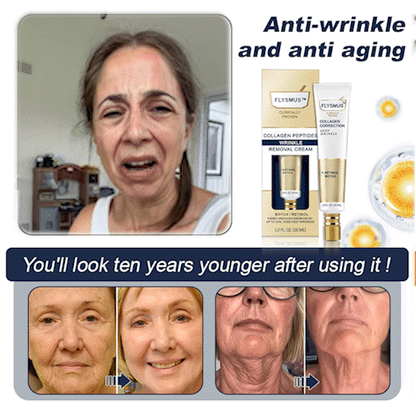 💝Flysmus™ Collagen Peptides Wrinkle Removal Cream - Last Day Promotion 70% OFF