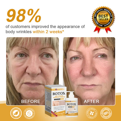 🔥Last Day Promotion 70% OFF - Furzero™ Botox Bee Venom Wrinkle Firming Multi-Purpose Cream