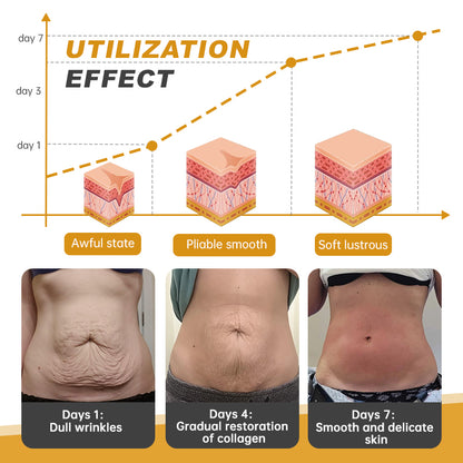 🔥Last Day Promotion 70% OFF - Furzero™ Botox Bee Venom Wrinkle Firming Multi-Purpose Cream