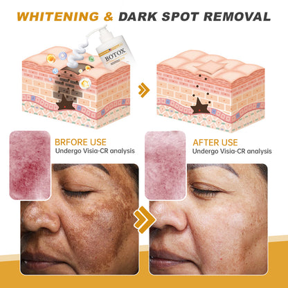 🔥Last Day Promotion 70% OFF - Furzero™ Botox Bee Venom Wrinkle Firming Multi-Purpose Cream