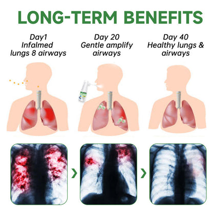 🌿🌿Furzero™️  RespiClean Herbal Lung and Breath Spray