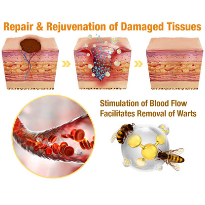 flysmus™ TagRecede Bee Venom Treatment Spray--