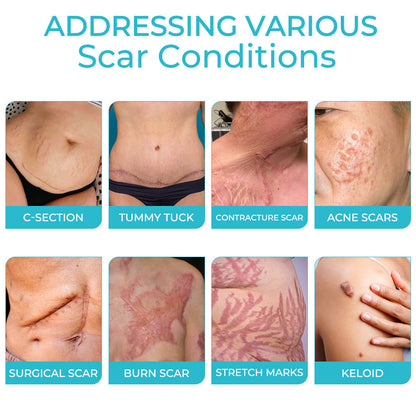 GFOUK™ Scafree Advanced Skin Spray-