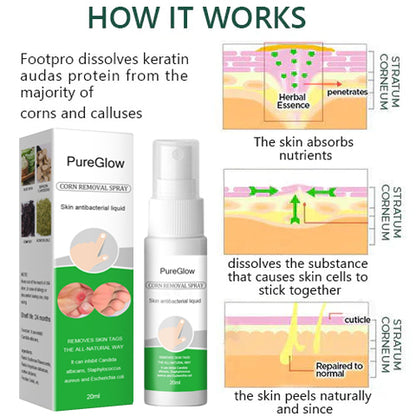 PureGlow™ Corn Remover Powerful Spray