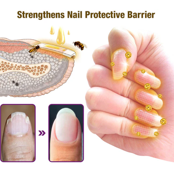 🐝🐝flysmus™ Fungus-Fres Bee Venom Nail Treatment Serum