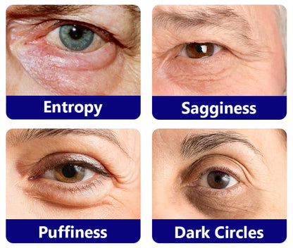 Furzero™ Deep Reviving Peptide Lifting Eye Gel