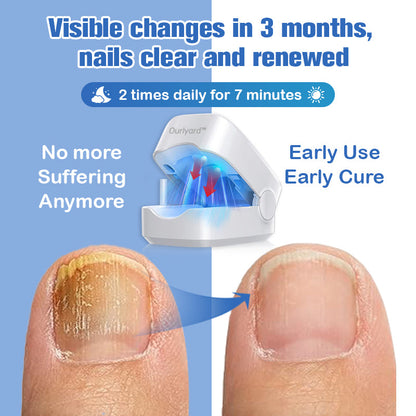 Furzero™ Nail Fungus Laser Therapy Device-