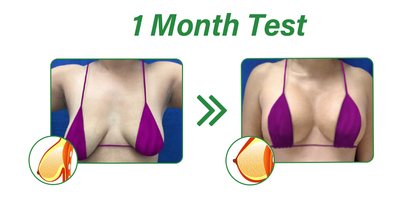 Furzero™ Organic B𝖗𝖊𝖆𝖘𝖙 Lifting&Firming Essentials