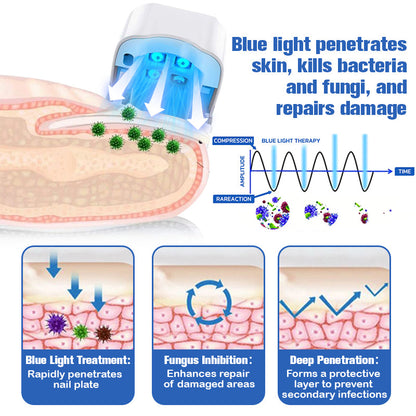 Furzero™ Nail Fungus Laser Therapy Device-