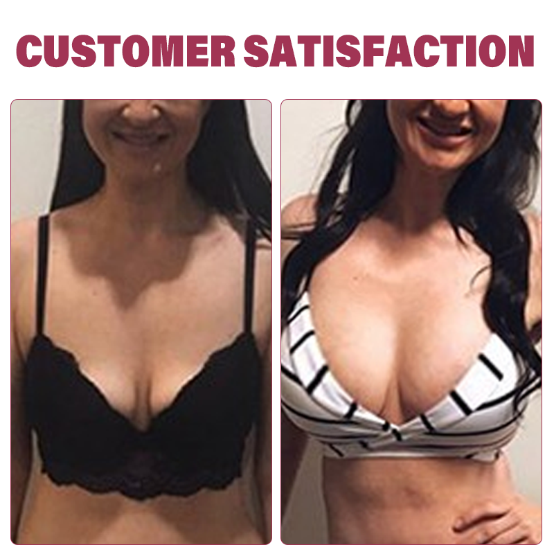 Sugoola™ Natural SizeUp Keratopeptide Protein Patch Pro